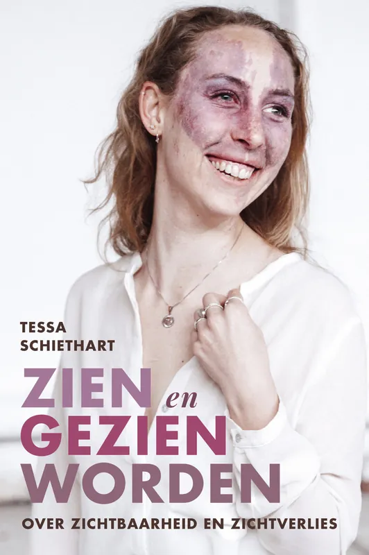 Gereduceerde Prijs Zien en gezien worden