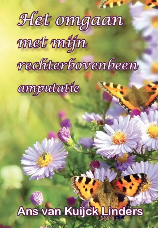 Shop Nu het omgaan met mijn rechter bovenbeen amputatie / Druk 1