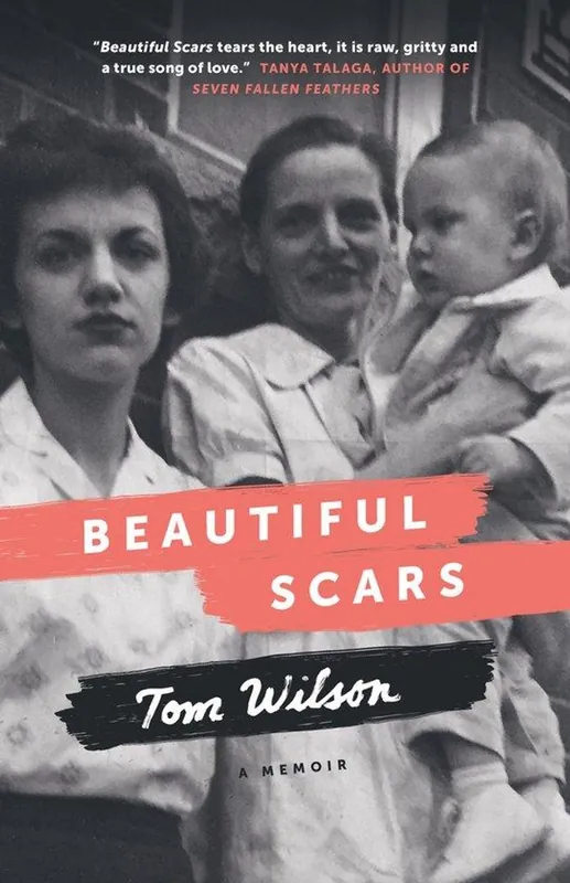 Beautiful Scars - Tom Wilson Actieprijs